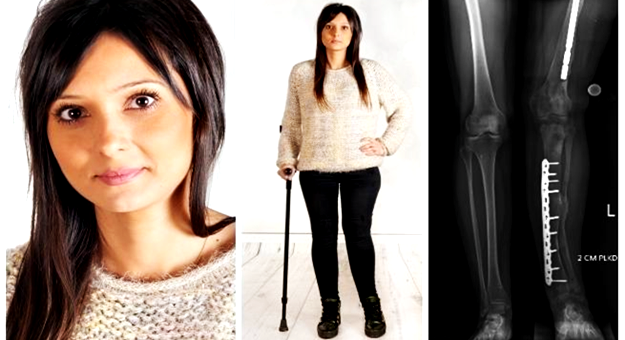 W niedzielę zagrają dla Agnieszki. 29-latka  cierpi na nowotwór niezłośliwy kości lewej nogi