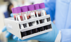 Informacje z terenu powiatu ząbkowickiego dotyczące koronawirusa - 28.04, godz. 9