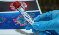 Wyzdrowiała ósma osoba. Informacje z terenu powiatu ząbkowickiego dot. koronawirusa - 6.05, godz. 10