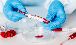 Ponad sto kolejnych przypadków, zmarła czternasta osoba - aktualne dane dot. koronawirusa - 18.11