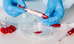 Aktualne informacje z terenu powiatu ząbkowickiego dotyczące koronawirusa - 12.12, godz. 10