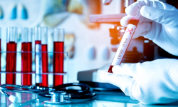 Kilkadziesiąt nowych przypadków zakażeń koronawirusem w powiecie ząbkowickim - 15.01, g.10