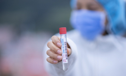 Aktualne informacje z terenu powiatu ząbkowickiego dotyczące koronawirusa - 30.01, godz. 10.30