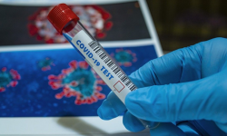 Aktualne informacje z terenu powiatu ząbkowickiego dotyczące koronawirusa - 03.02, godz. 10.30