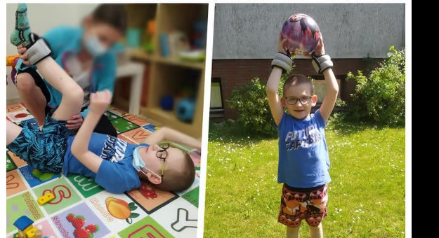 10-letni Michał od urodzenia zmaga się z przeciwnościami, które uniemożliwiły mu normalny rozwój. Stwierdzono u niego niedosłuch spowodowany przerostem migdałków, padaczkę i wiotkość mięśni. Po konsultacji z genetykiem rodzice usłyszeli, że ich dziecko najprawdopodobniej choruje na bardzo rzadką chorobę genetyczną – zespół Kabuki